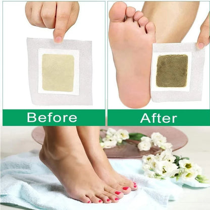 Detox Foot Patches - Stress Relief & Detoxification (Pack of 10)